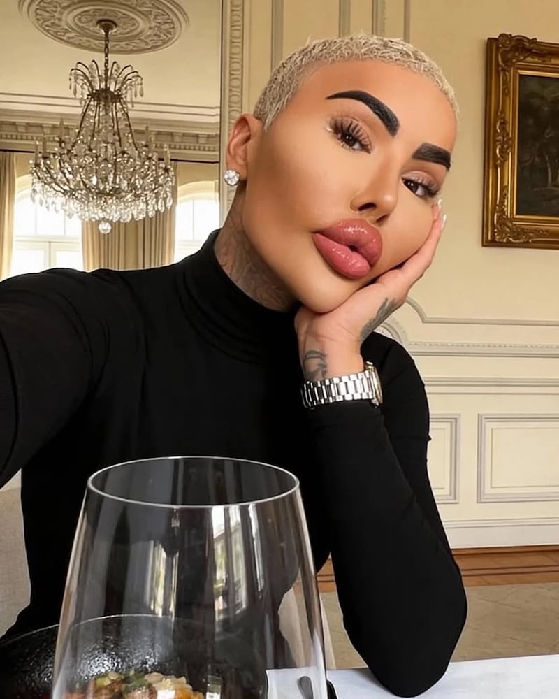 Murió Jordan James Parke, el “Lip King”