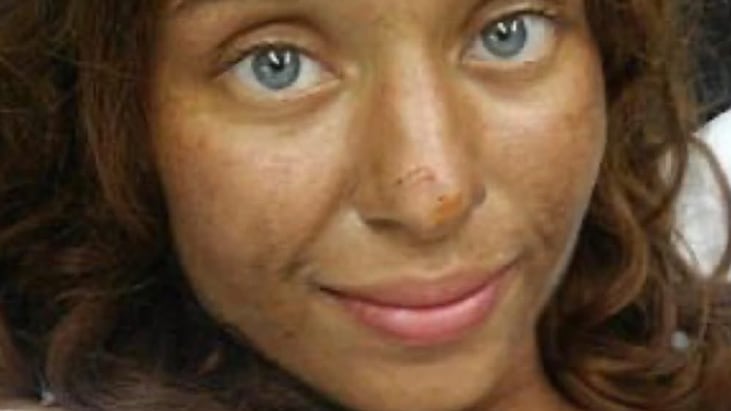 Mujer que desapareció sin dejar rastro sobrevivió un mes en el bosque comiendo hongos y bayas - Fuente: Foto de la web