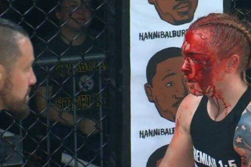 VIDEO. La MMA vio una de las peleas más sangrientas en su historia