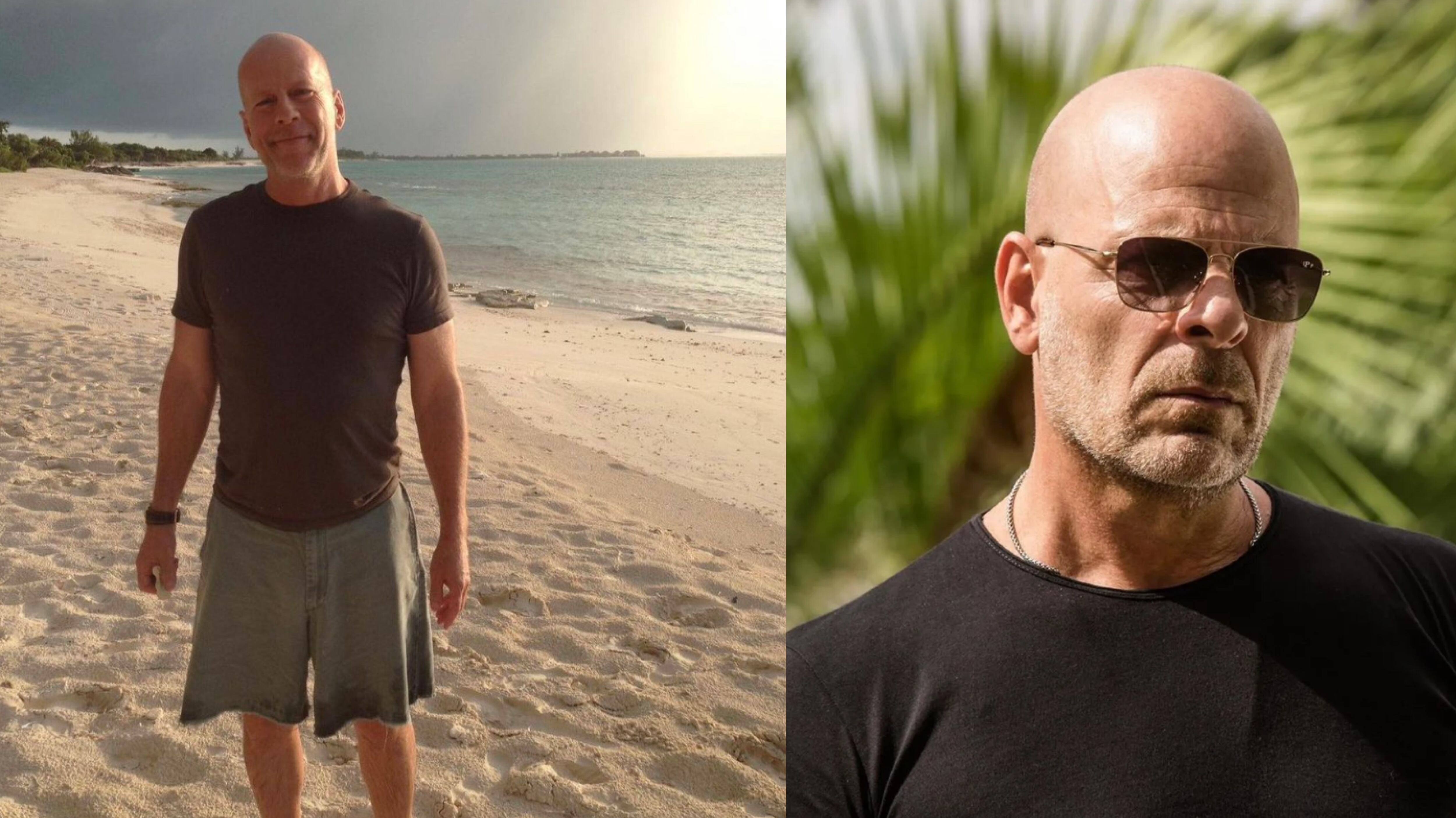 El actor alemán padece de una enfermedad que es irreversible y eventualmente pasará factura