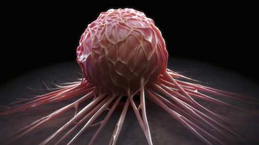 Getty Images/ Célula cancerígena