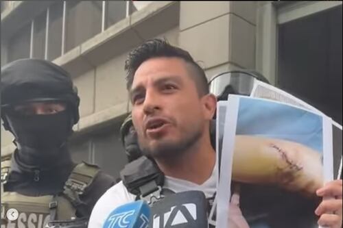 Daniel Salcedo mostró imágenes de las heridas de su hermano cuando intentaron asesinarlo