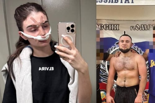 Luchador ruso de MMA golpeó a su esposa y le fracturó la nariz por “mala limpieza”