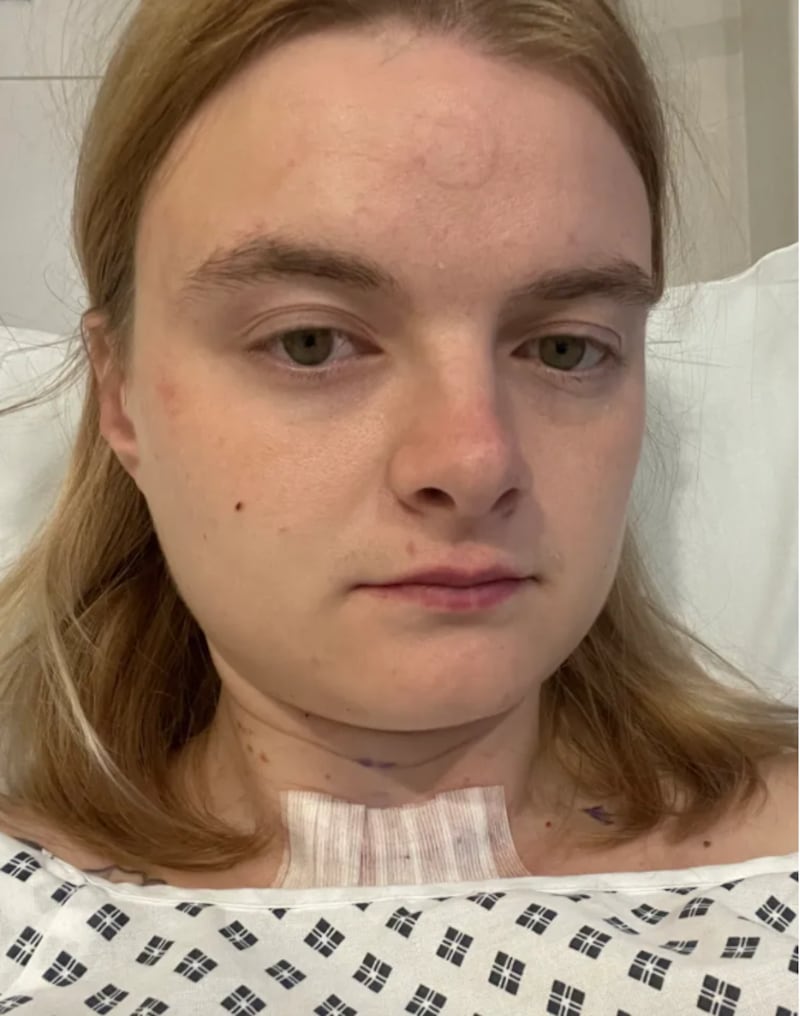 Mujer descubrió que tenía cáncer tras consultar sus resultados médicos en ChatGPT