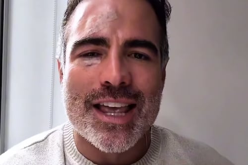 ¿Qué le pasó en el rostro a Roberto Manrique? Así quedó su rostro después de accidente