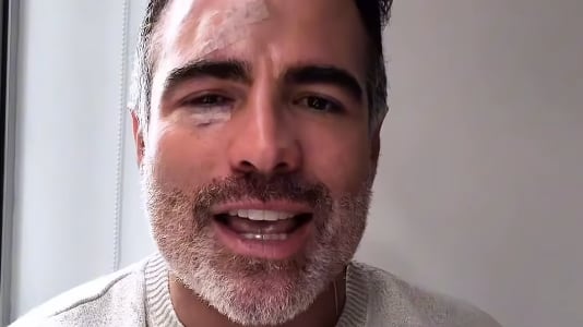 El actor ecuatoriano Roberto Manrique sufrió un accidente en su preestreno Tantas Flores.