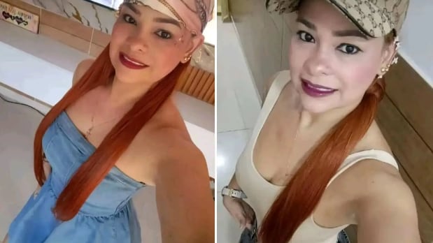 Una mujer de 40 años muere tras una liposucción en brazos y cuerpo realizada en una clínica clandestina