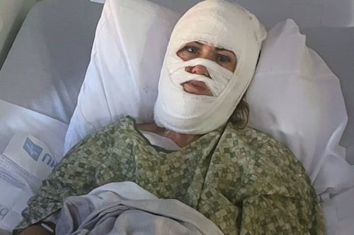 Mujer fue atacada con ácido por un hombre desconocido mientras caminaba por un parque