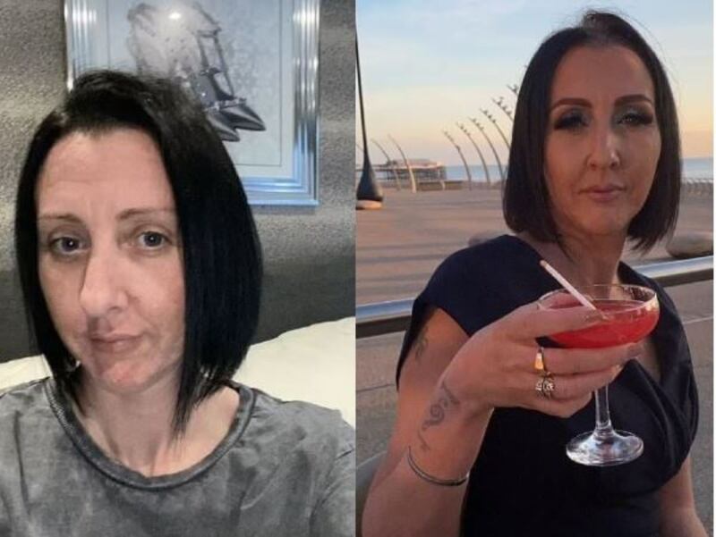 Antes y después de Emma Sheppard