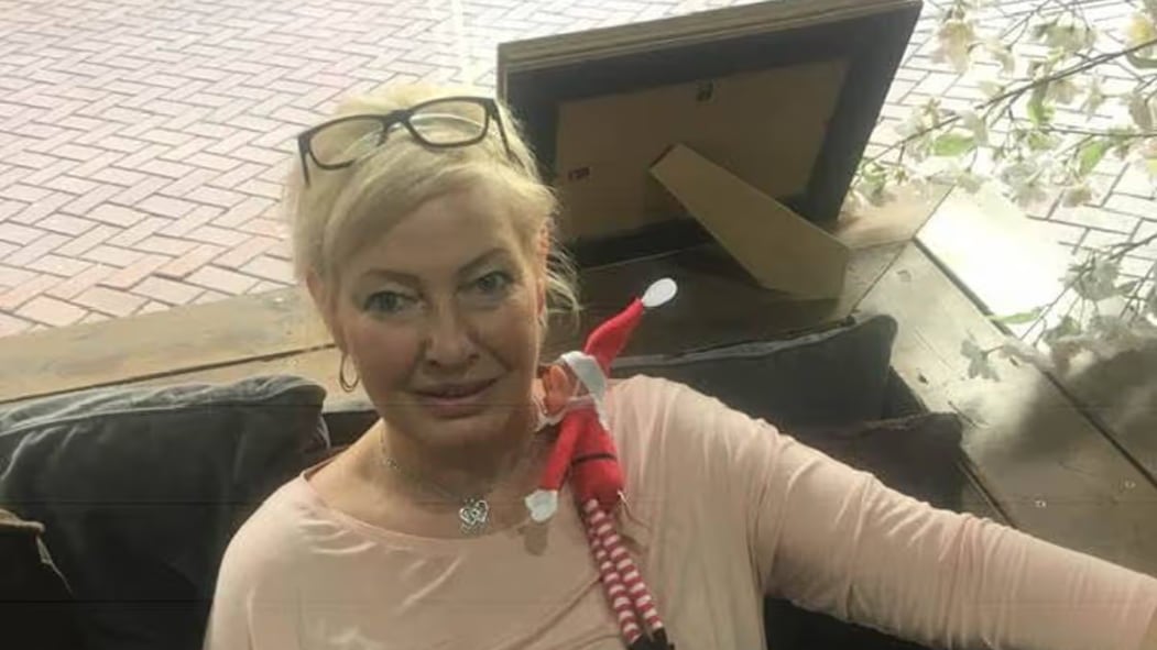 Mujer murió de rabia cuatro meses después de ser arañada por un perro