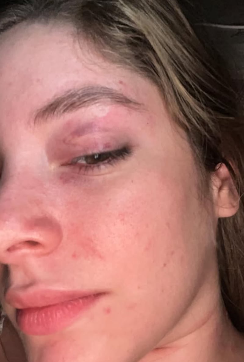 Instagram Nicolle Aray