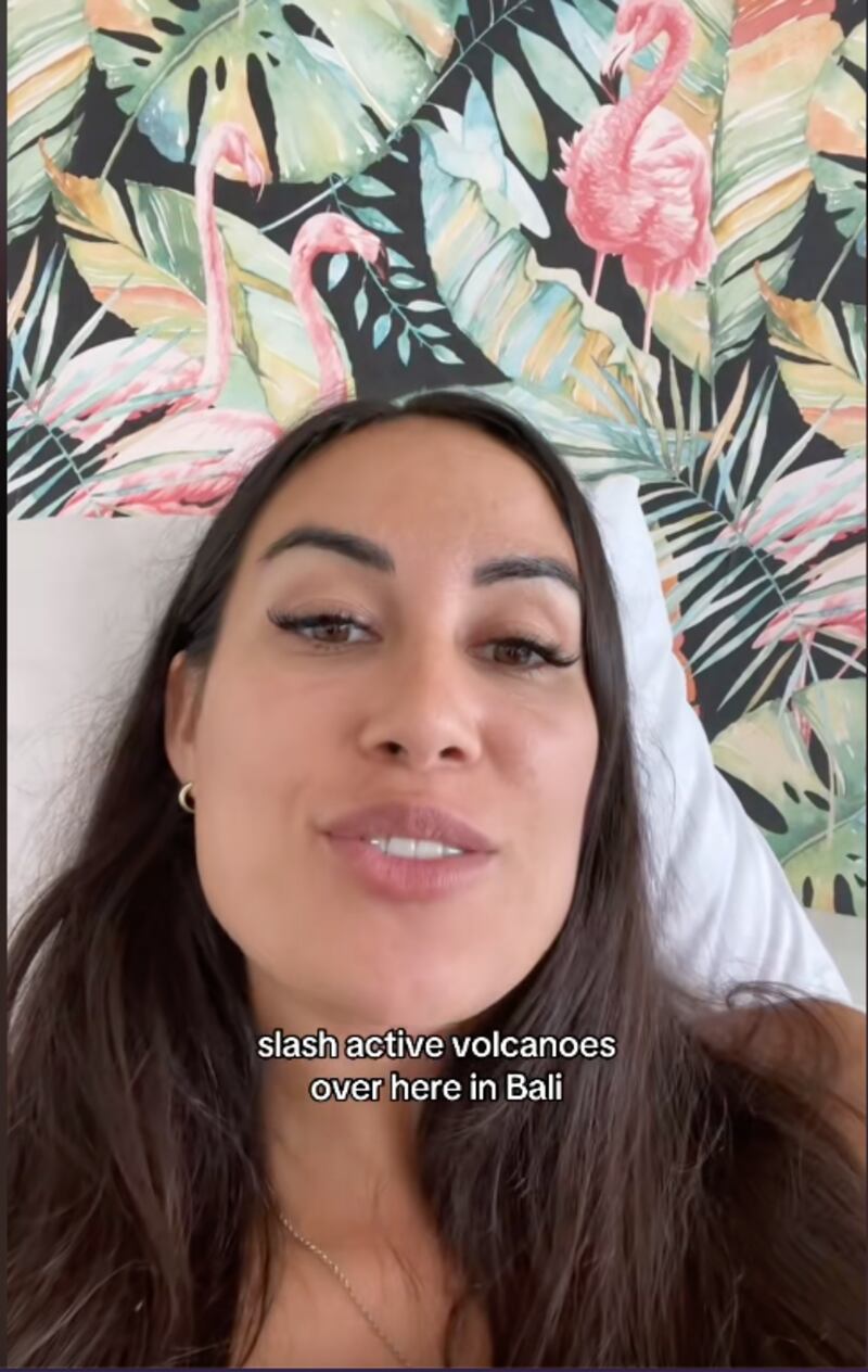 Así lucía modelo antes de operarse su rostro, a reducción de frente y fox eyes
