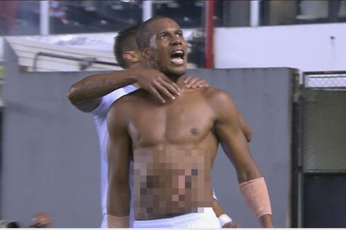 FOTOS: Jugador celebra triplete mostrando su abdomen sin piel ¡ouch!